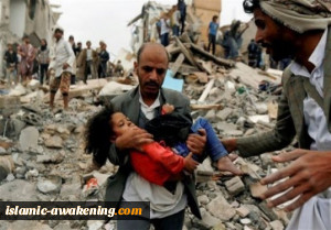 الیمن اختبار لنزاهة الدول الغربیة فی الدفاع عن حقوق الإنسان