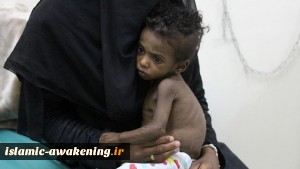 Nearly 400K Yemeni children under five could starve to death in 2021: UN agencies