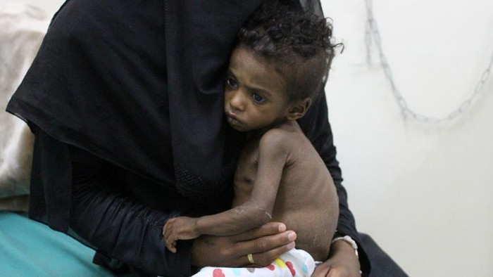 Nearly 400K Yemeni children under five could starve to death in 2021: UN agencies