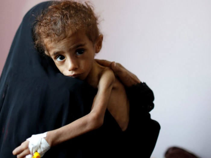 UK slashes urgently needed Yemen aid at UN confab